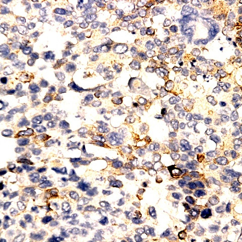 PRL b-subunit Antibody in Immunohistochemistry (Paraffin) (IHC (P))