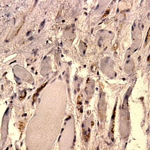 PRL b-subunit Antibody in Immunohistochemistry (Paraffin) (IHC (P))