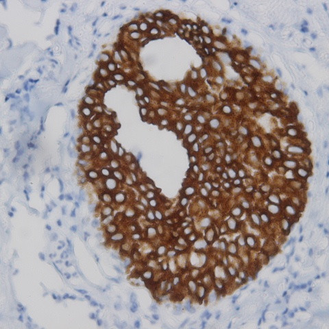 PSA Antibody in Immunohistochemistry (Paraffin) (IHC (P))