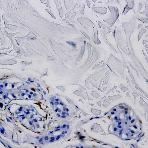 Tat epitope 2 Antibody in Immunohistochemistry (Paraffin) (IHC (P))