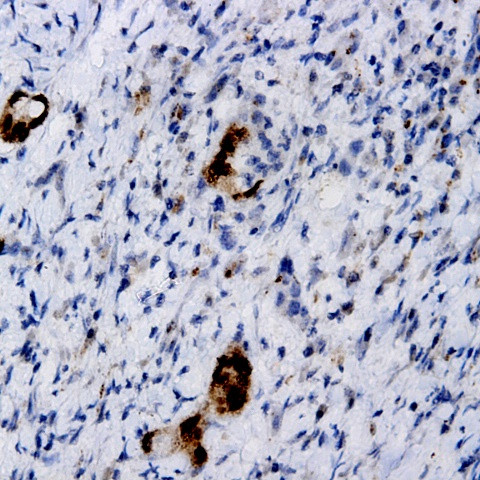 TSH b-subunit Antibody in Immunohistochemistry (Paraffin) (IHC (P))