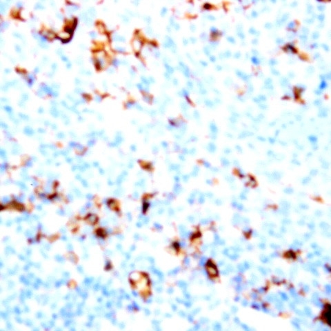 CD51 Antibody in Immunohistochemistry (Paraffin) (IHC (P))