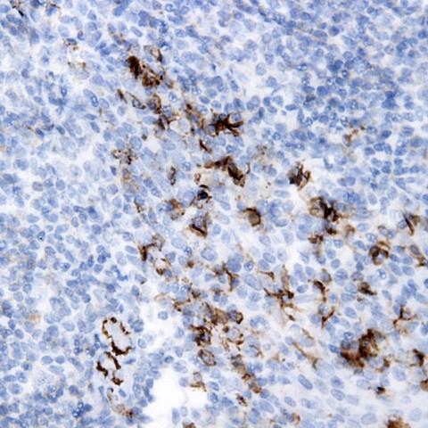 Myosin Heavy Chain, Cardiac Antibody in Immunohistochemistry (Paraffin) (IHC (P))