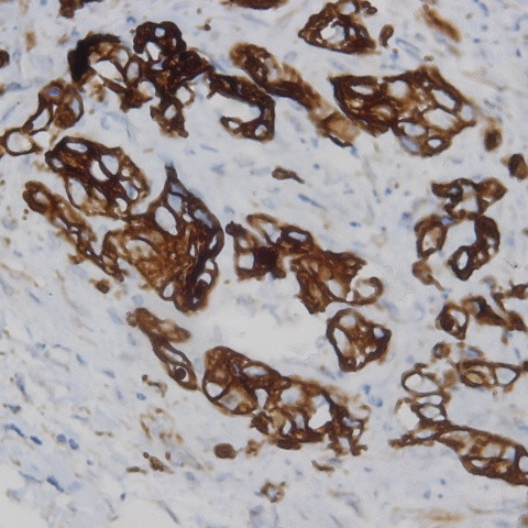 Tumor-Associated Glycoprotein (TAG-72) Antibody in Immunohistochemistry (Paraffin) (IHC (P))