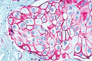 GLEPP-1 Antibody in Immunohistochemistry (Paraffin) (IHC (P))