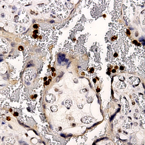 Uroplakin-2 Antibody in Immunohistochemistry (Paraffin) (IHC (P))