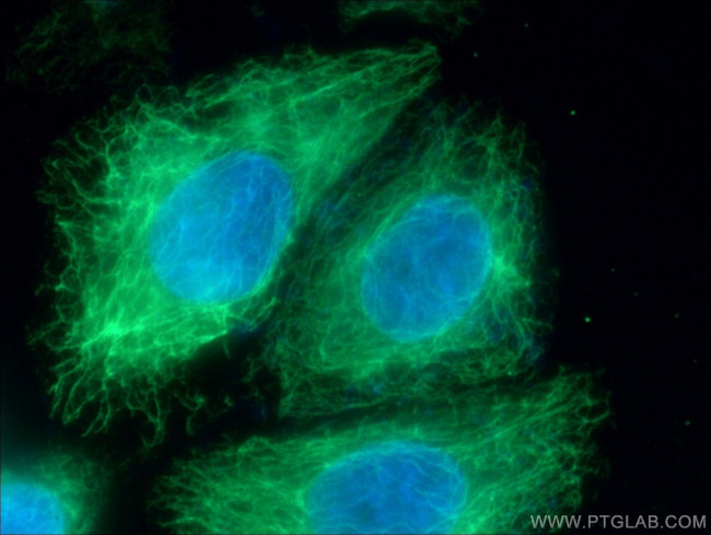 BID Antibody in Immunocytochemistry (ICC/IF)