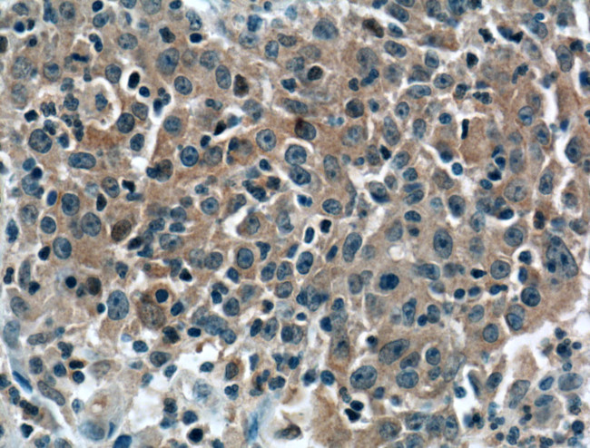 BID Antibody in Immunohistochemistry (Paraffin) (IHC (P))