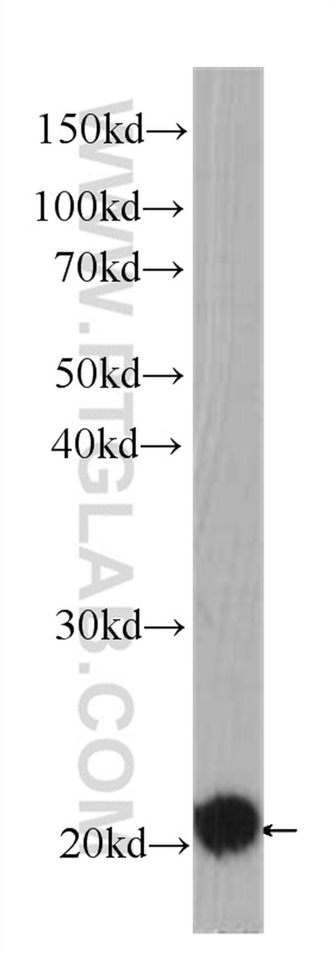 BID Antibody in Western Blot (WB)