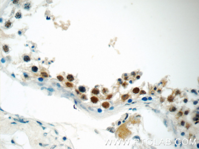 SIRT1 Antibody in Immunohistochemistry (Paraffin) (IHC (P))