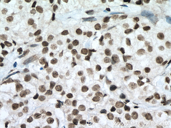 SIRT1 Antibody in Immunohistochemistry (Paraffin) (IHC (P))