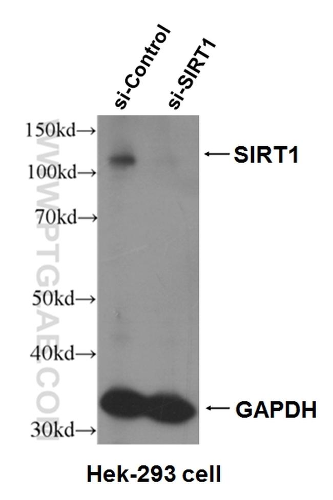 SIRT1 Antibody in Western Blot (WB)