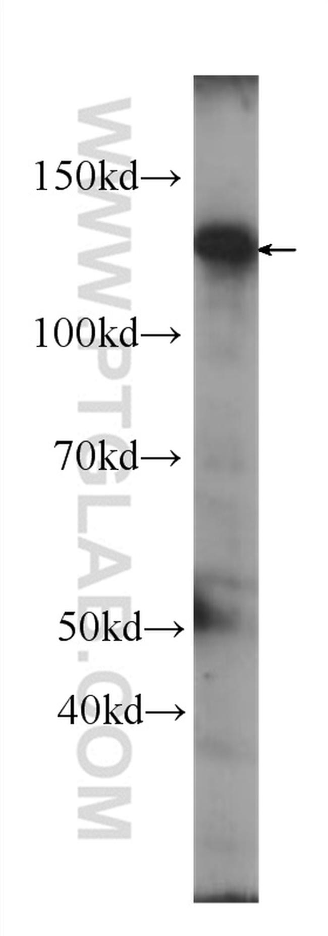 SIRT1 Antibody in Western Blot (WB)