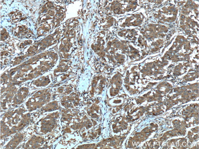 SGTA Antibody in Immunohistochemistry (Paraffin) (IHC (P))