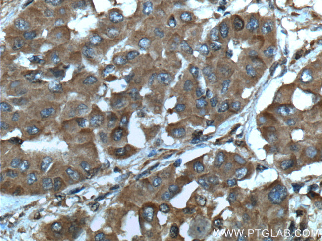 SGTA Antibody in Immunohistochemistry (Paraffin) (IHC (P))