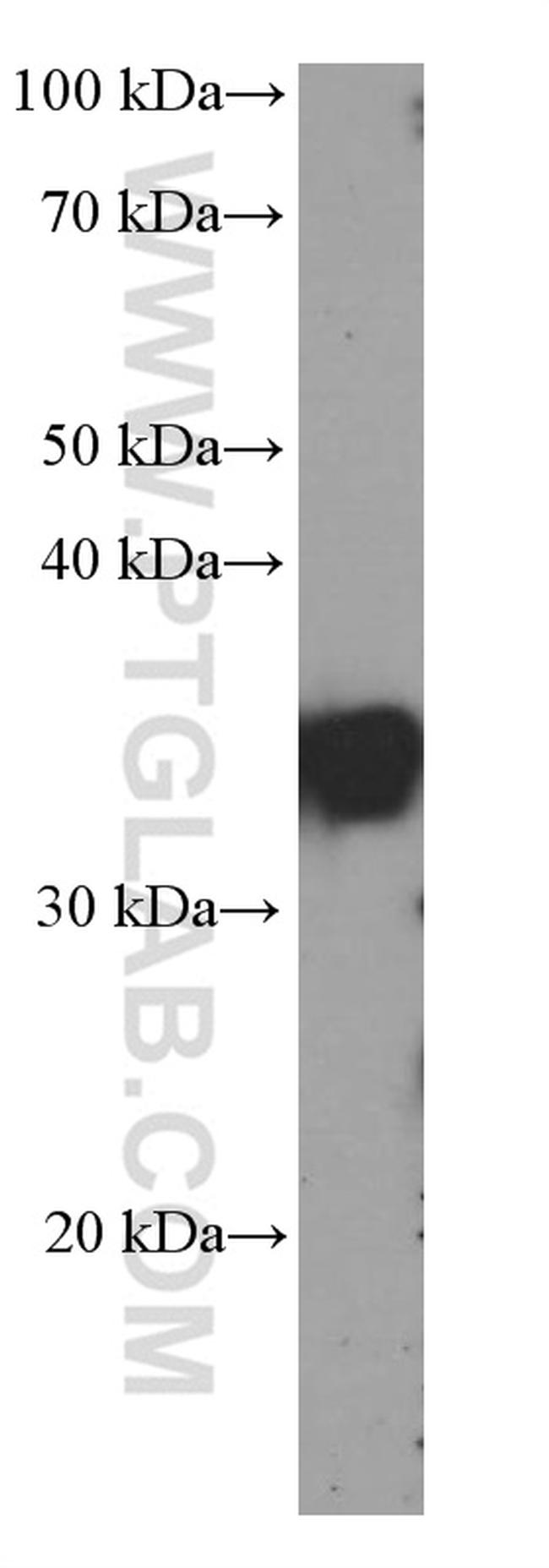 SGTA Antibody in Western Blot (WB)