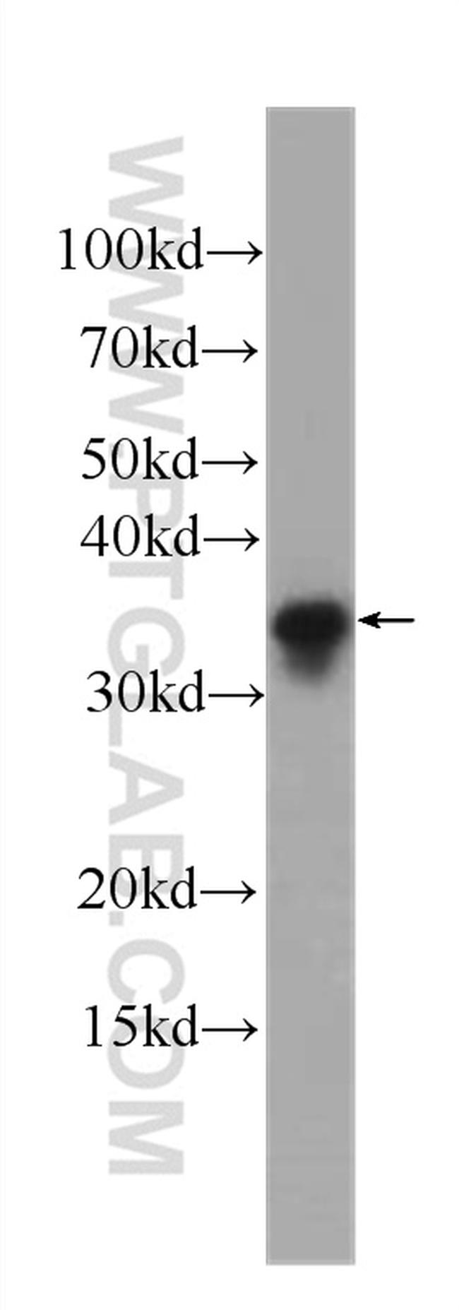 SGTA Antibody in Western Blot (WB)