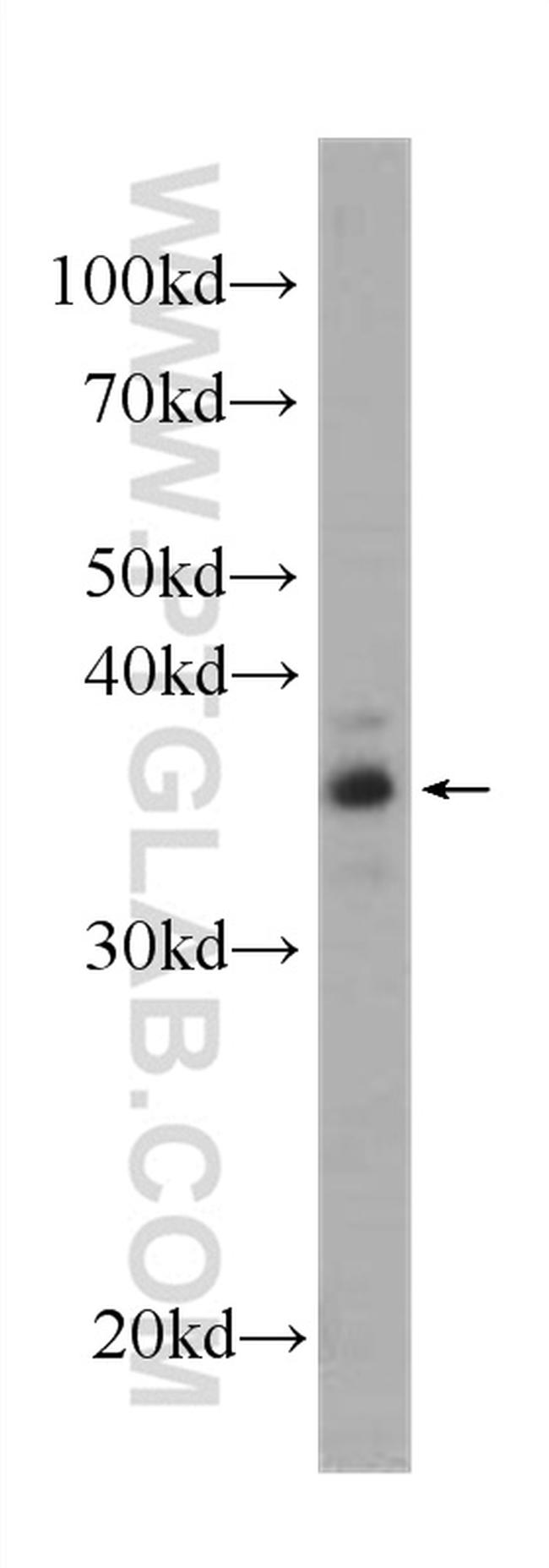 SGTA Antibody in Western Blot (WB)