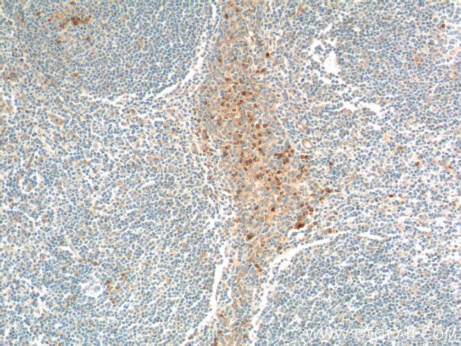 IL2 Antibody in Immunohistochemistry (Paraffin) (IHC (P))