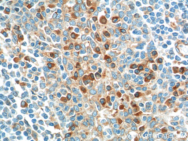 IL2 Antibody in Immunohistochemistry (Paraffin) (IHC (P))