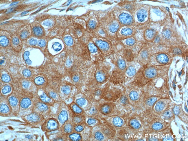 IL2 Antibody in Immunohistochemistry (Paraffin) (IHC (P))