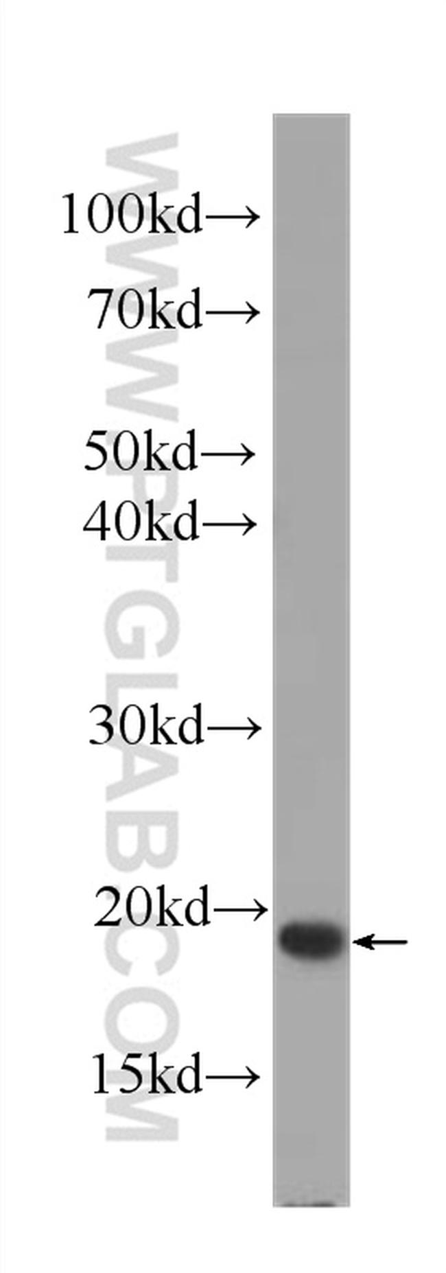 IL2 Antibody in Western Blot (WB)