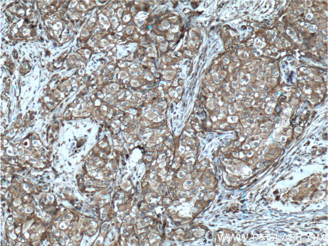 pan Ras Antibody in Immunohistochemistry (Paraffin) (IHC (P))