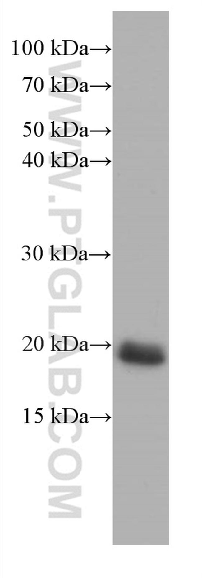 pan Ras Antibody in Western Blot (WB)