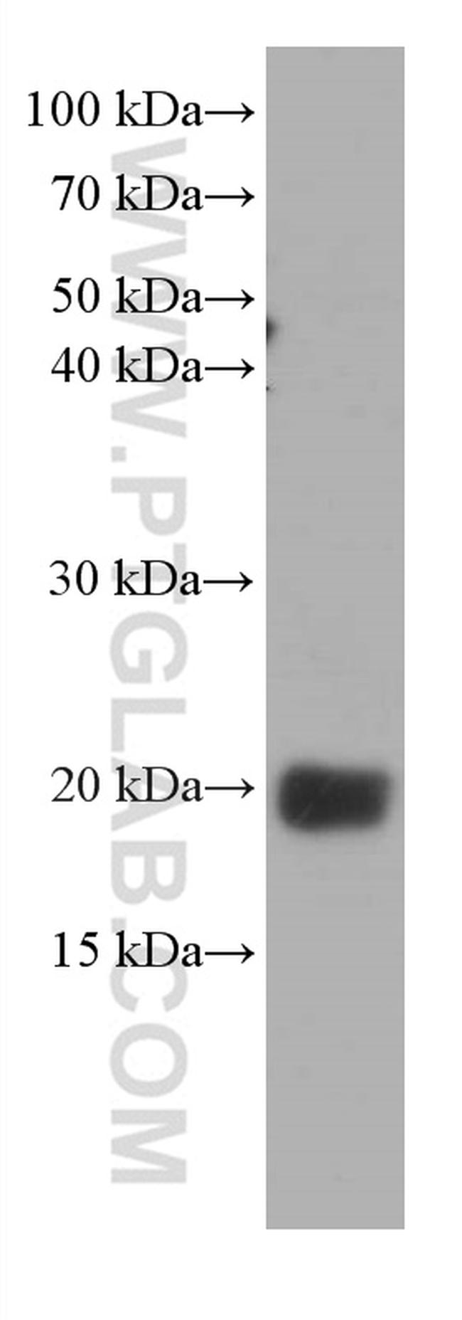 pan Ras Antibody in Western Blot (WB)