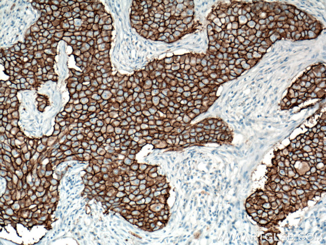 HER2/ErbB2 Antibody in Immunohistochemistry (Paraffin) (IHC (P))