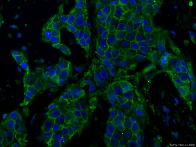 HER2/ErbB2 Antibody in Immunohistochemistry (PFA fixed) (IHC (PFA))