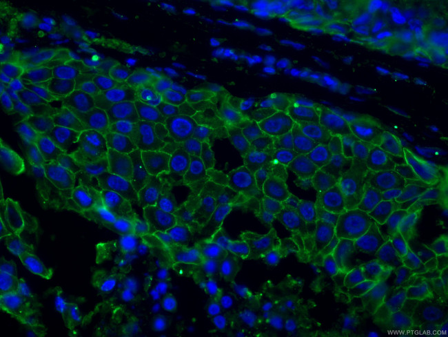 HER2/ErbB2 Antibody in Immunohistochemistry (PFA fixed) (IHC (PFA))