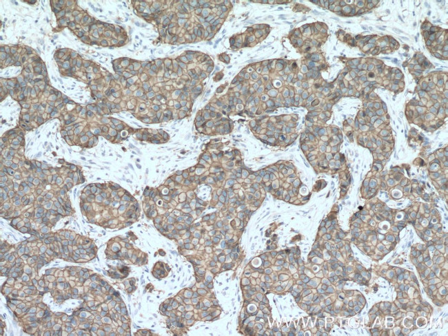 HER2/ErbB2 Antibody in Immunohistochemistry (Paraffin) (IHC (P))