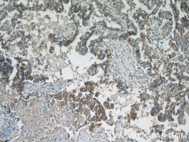 HER2/ErbB2 Antibody in Immunohistochemistry (Paraffin) (IHC (P))