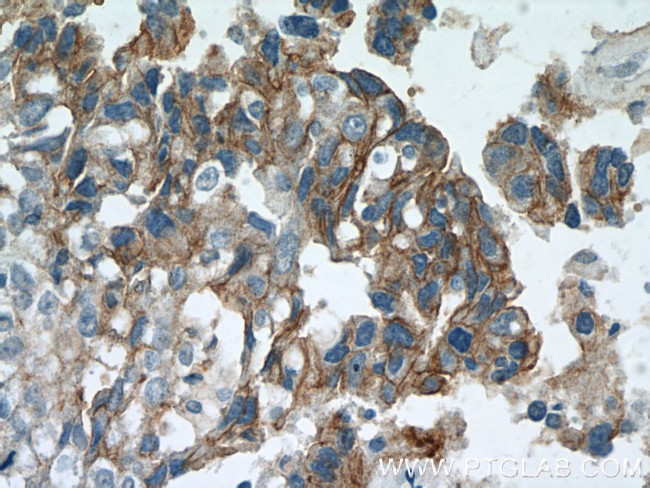 HER2/ErbB2 Antibody in Immunohistochemistry (Paraffin) (IHC (P))