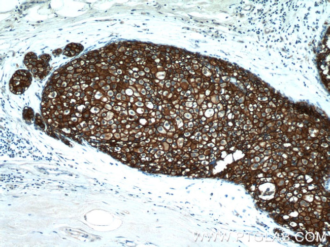 HER2/ErbB2 Antibody in Immunohistochemistry (Paraffin) (IHC (P))