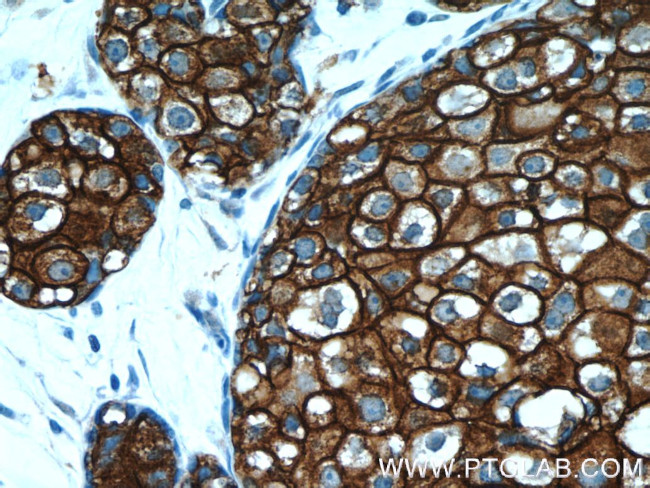 HER2/ErbB2 Antibody in Immunohistochemistry (Paraffin) (IHC (P))