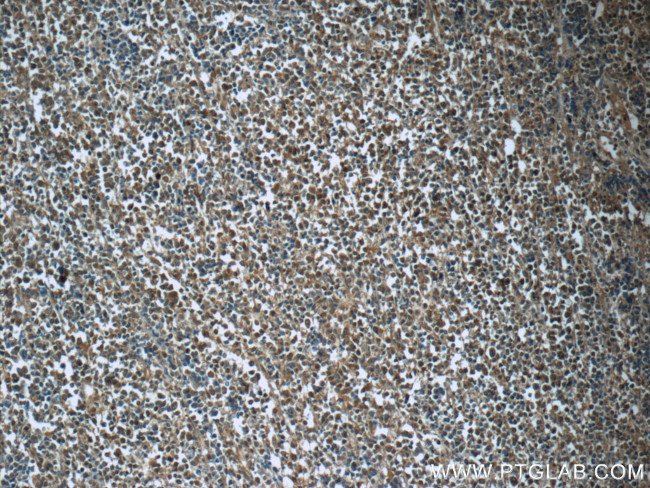 CDK2 Antibody in Immunohistochemistry (Paraffin) (IHC (P))