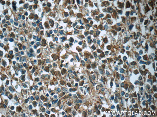 CDK2 Antibody in Immunohistochemistry (Paraffin) (IHC (P))