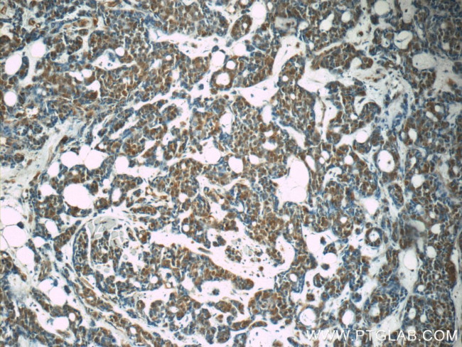 CDK2 Antibody in Immunohistochemistry (Paraffin) (IHC (P))