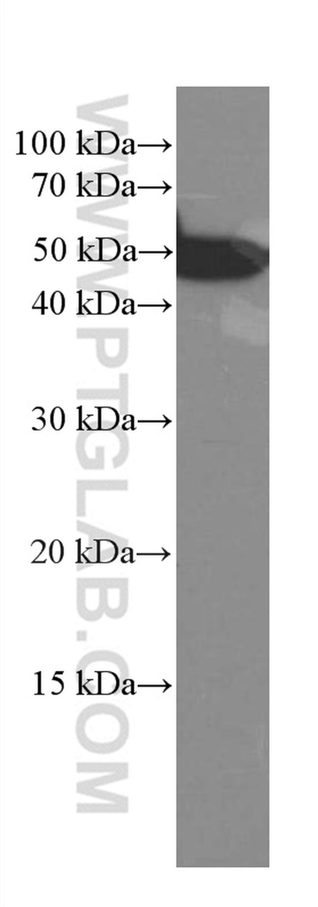 CREST Antibody in Western Blot (WB)