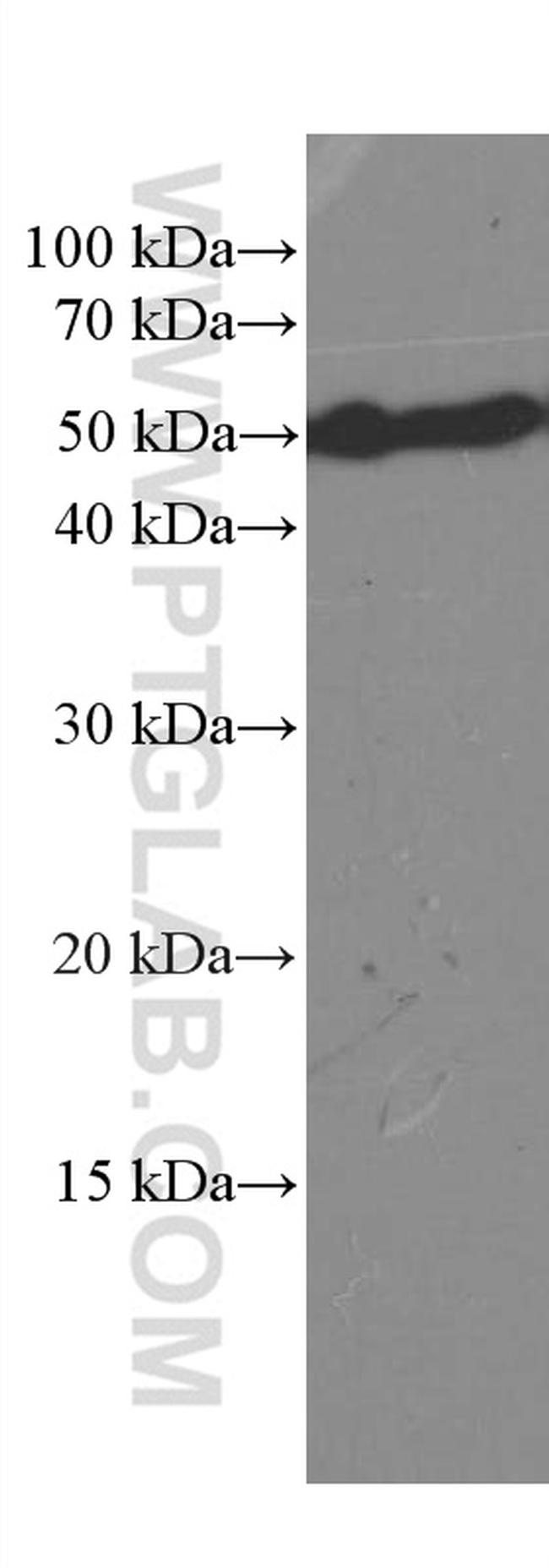 CREST Antibody in Western Blot (WB)