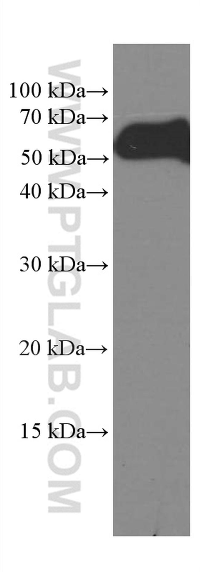 CREST Antibody in Western Blot (WB)