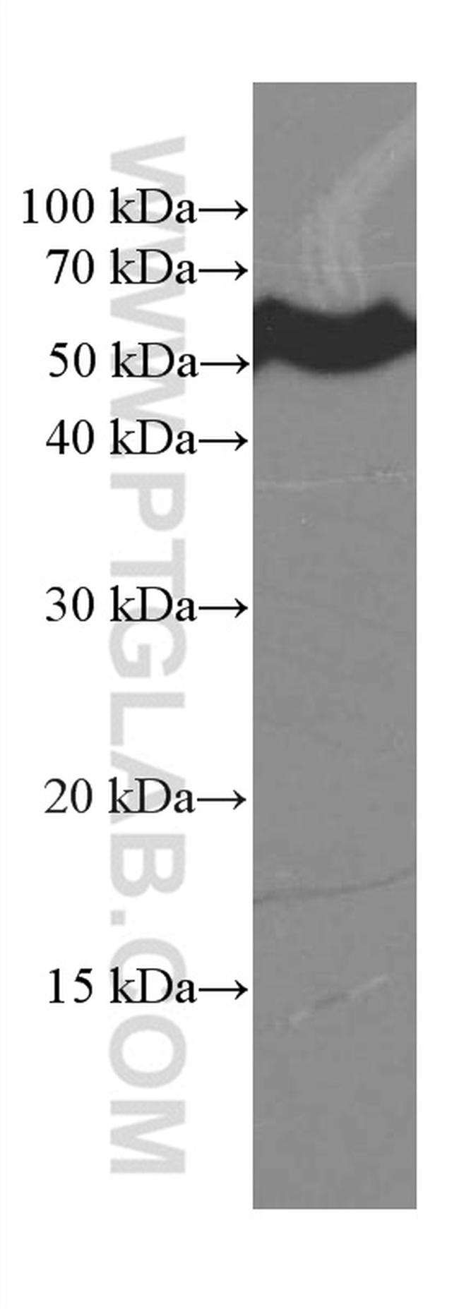 CREST Antibody in Western Blot (WB)