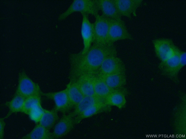 c-SRC Antibody in Immunocytochemistry (ICC/IF)