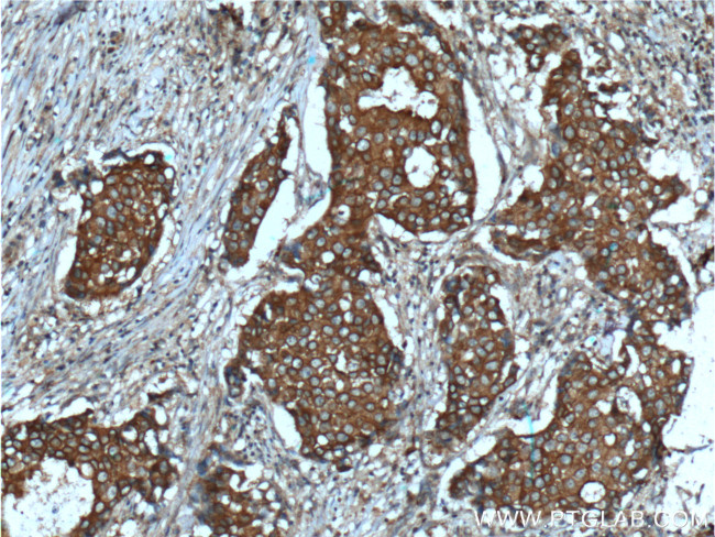 c-SRC Antibody in Immunohistochemistry (Paraffin) (IHC (P))