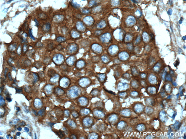c-SRC Antibody in Immunohistochemistry (Paraffin) (IHC (P))