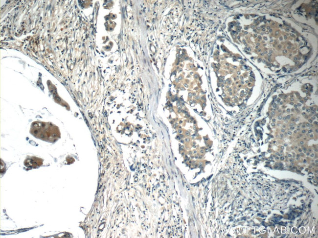 c-SRC Antibody in Immunohistochemistry (Paraffin) (IHC (P))