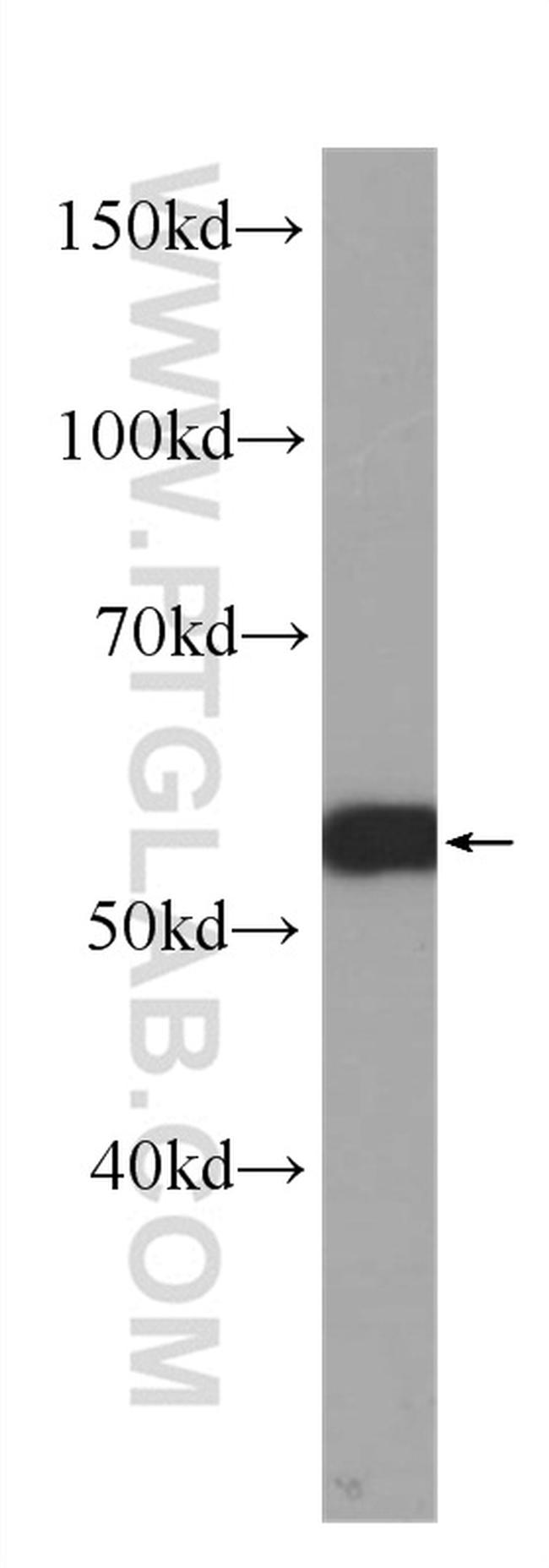 c-SRC Antibody in Western Blot (WB)