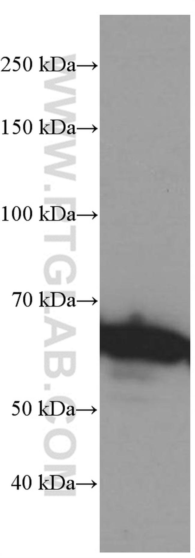 c-SRC Antibody in Western Blot (WB)